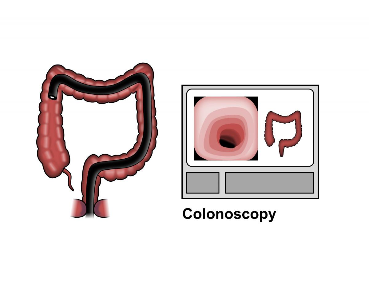 Colonoscopy. Inside of Healthy Colon, Large Intestine Stock