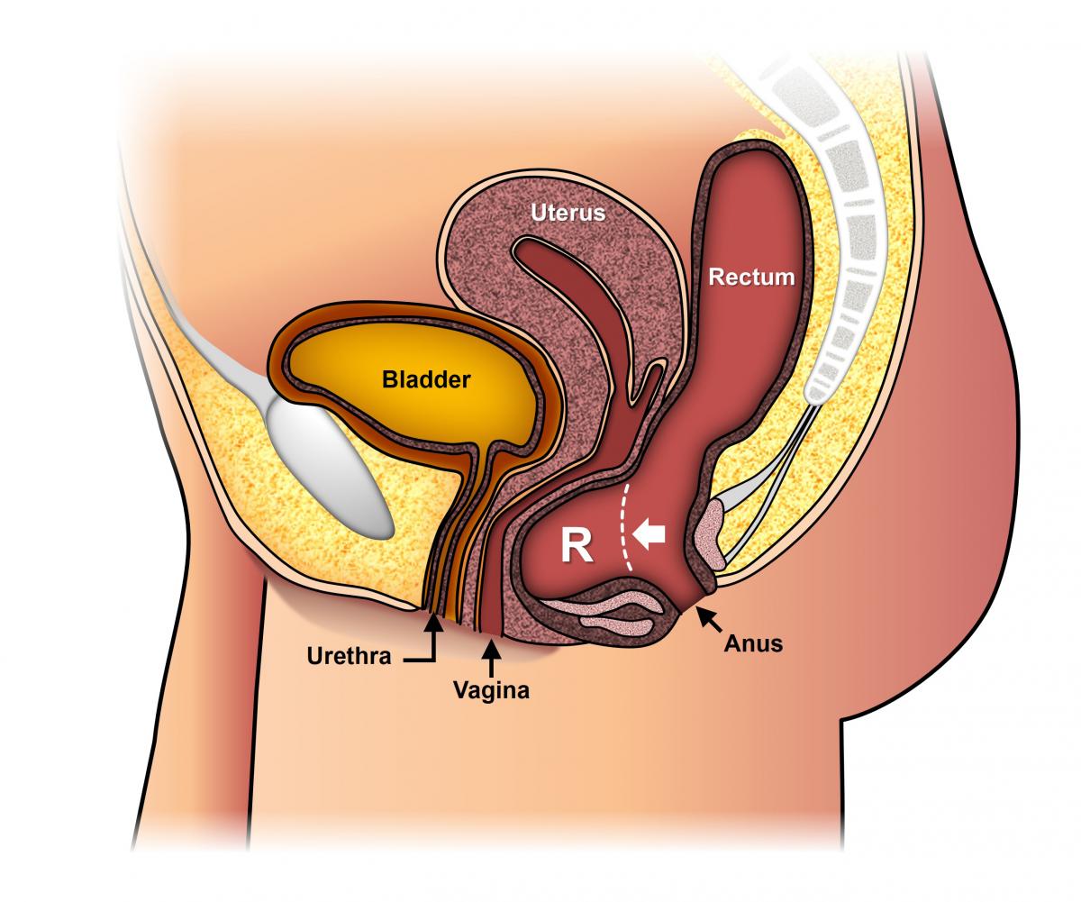 What is bladder prolapse? Causes and treatments